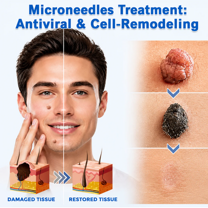 ✨Hiskin® 2-in-1 Microneedle & Hydrocolloid Patch🍀 | Removes raised moles, acne, flat warts, and skin tags | Helps improve wrinkles, scars, and blemishes | Invisible patches for face and body