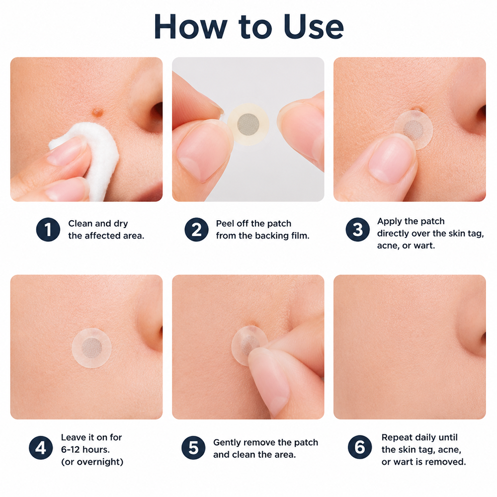 ✨Hiskin® 2-in-1 Microneedle & Hydrocolloid Patch🍀 | Removes raised moles, acne, flat warts, and skin tags | Helps improve wrinkles, scars, and blemishes | Invisible patches for face and body